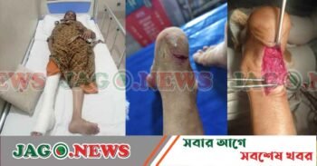 নবীগঞ্জে পূর্ব বিরোধের জেরে গৃহবধূর উপর হামলা, গুরুতর আহত